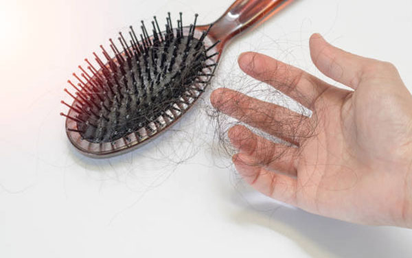 Vảy nến da đầu có thể gây rụng tóc